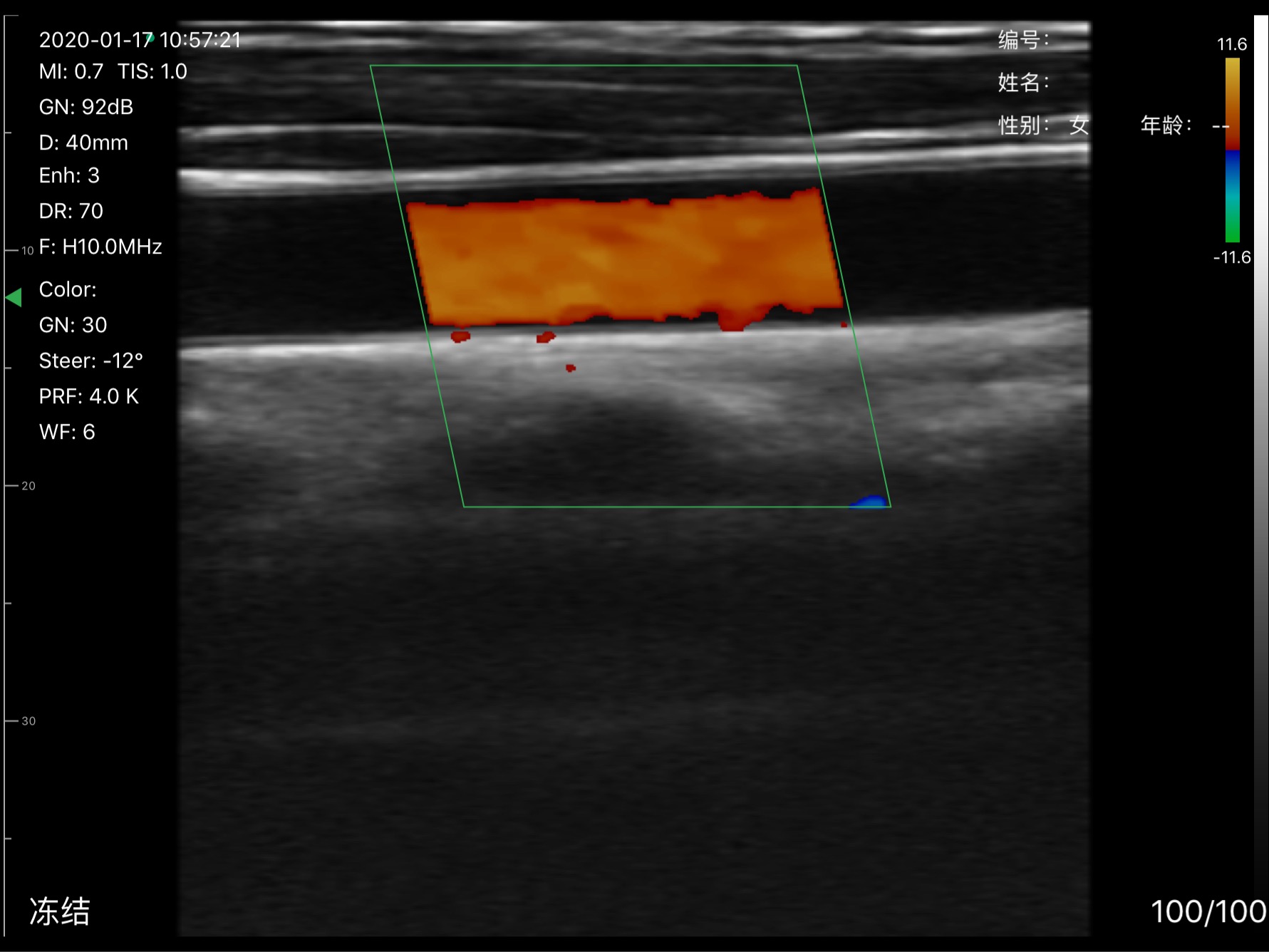 Carotid artery 2 · Color Doppler · D3Pro · 10 MHz scan preview