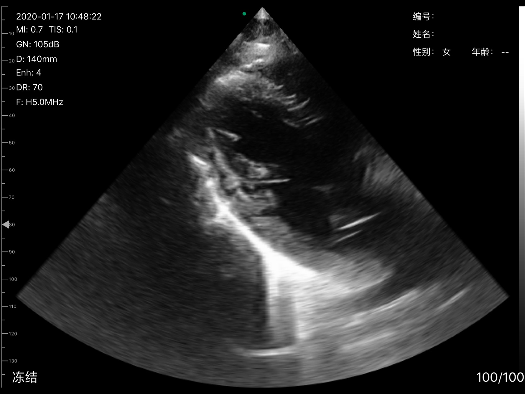 Cardiac view · B-mode · D3Pro · 5 MHz scan preview