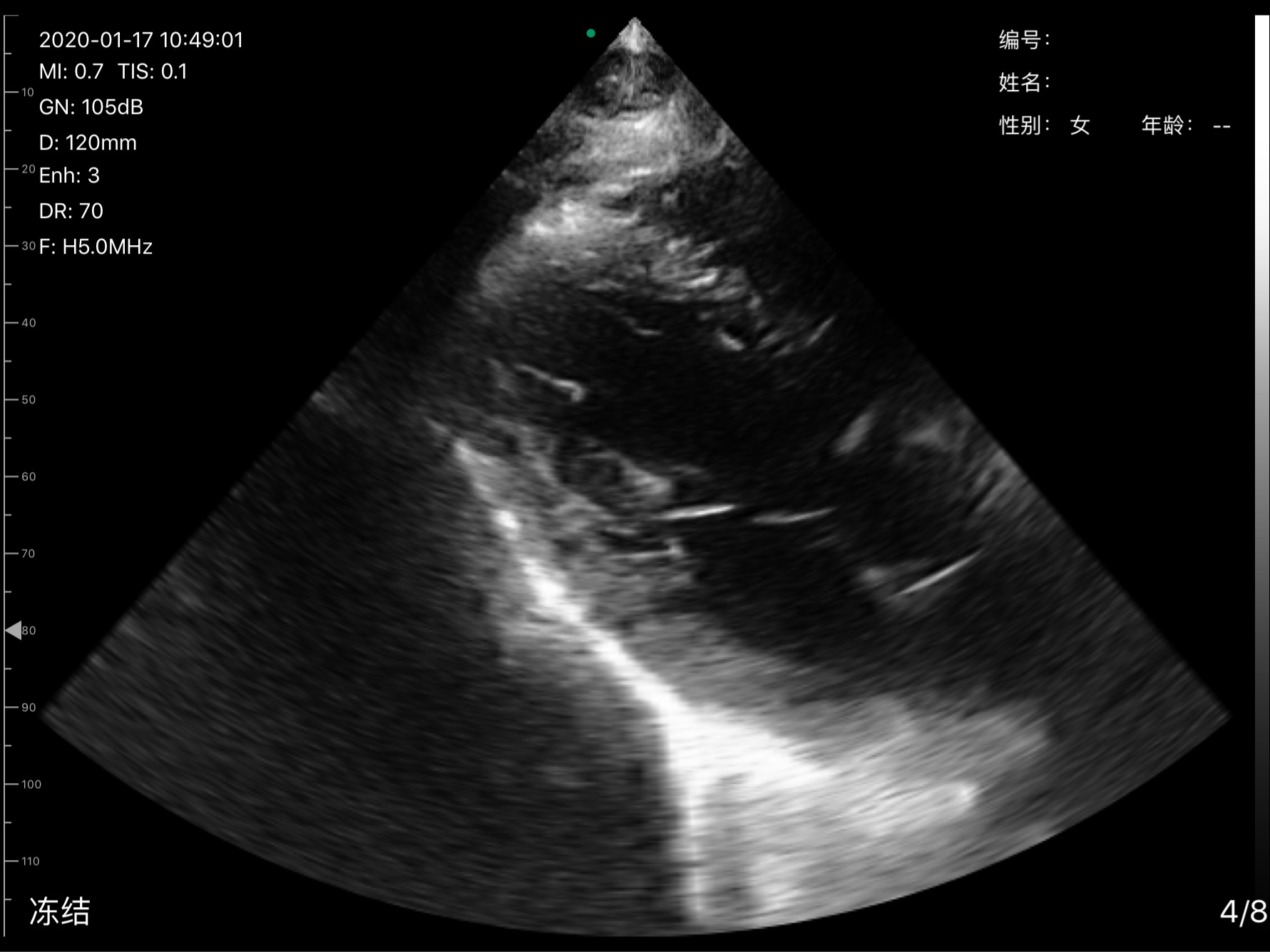 Cardiac view, 120 mm depth · B-mode · D3Pro · 5 MHz scan preview