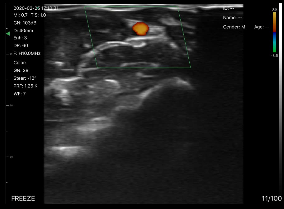 Wrist vessels · Color Doppler · D3Pro · Linear probe scan preview