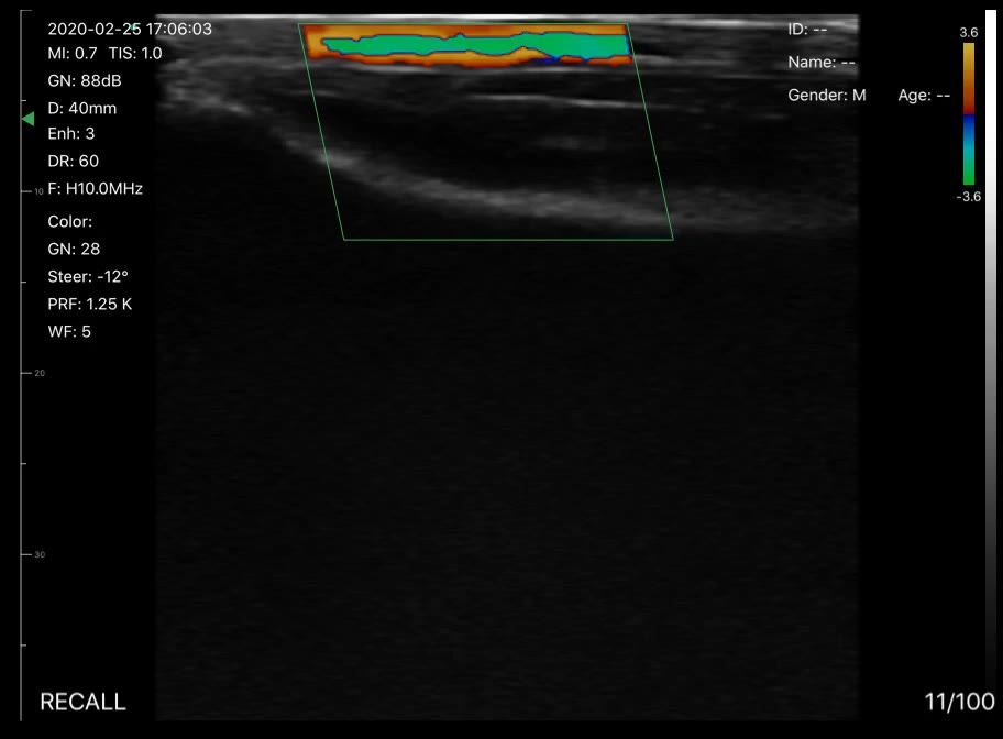 Wrist vessels 2 · Color Doppler · D3Pro · Linear probe scan preview