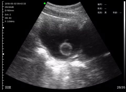 Bladder · B-mode · D3Ultra · Convex probe scan preview