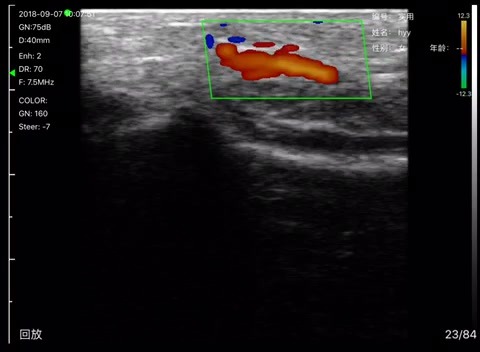 Forearm artery · Color Doppler · L10 · 7.5 MHz scan preview