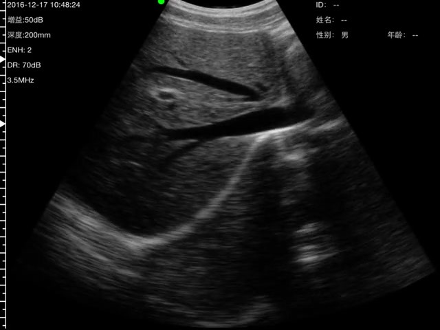 Hepatic veins · B-mode · C5SH · 3.5 MHz scan preview