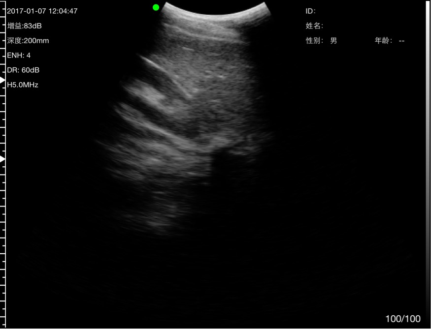 Convex abdominal view · B-mode · C5SH · 5 MHz scan preview