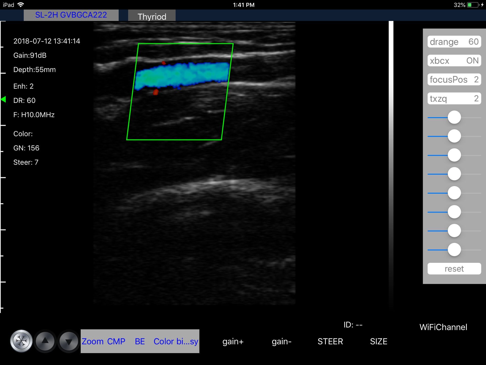 Basilic vein · Color Doppler · L10 · 10 MHz scan preview