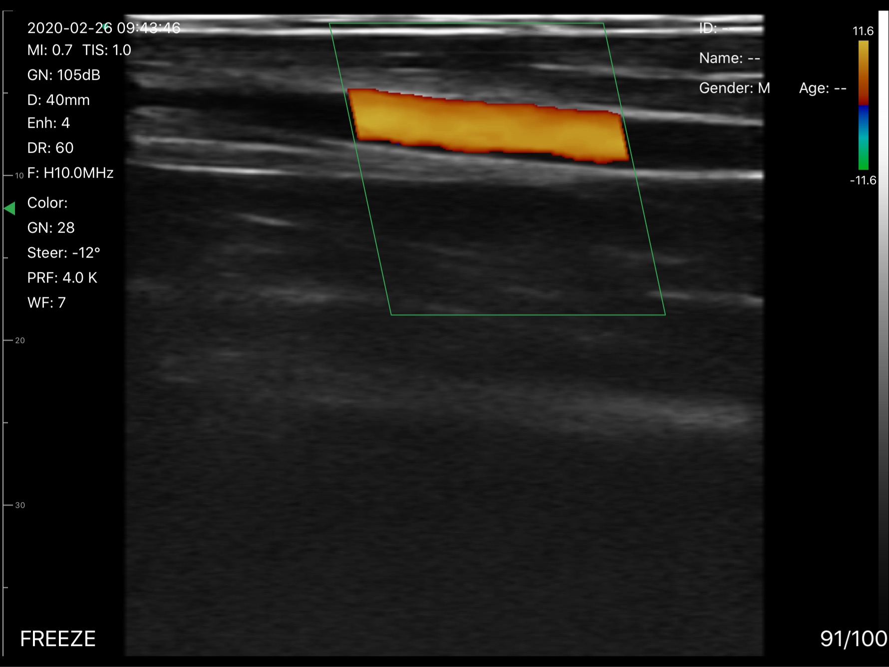 Wrist artery · Color Doppler · D3Pro · 10 MHz scan preview