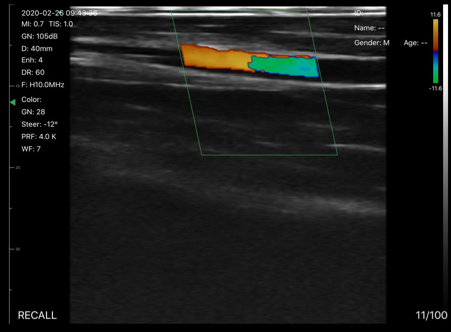 Wrist vessel · Color Doppler · D3Pro · 10 MHz scan preview