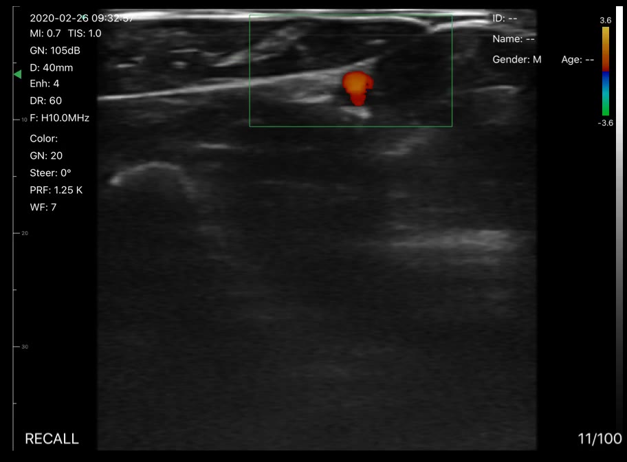 Wrist vessels 3 · Color Doppler · D3Pro · Linear probe scan preview