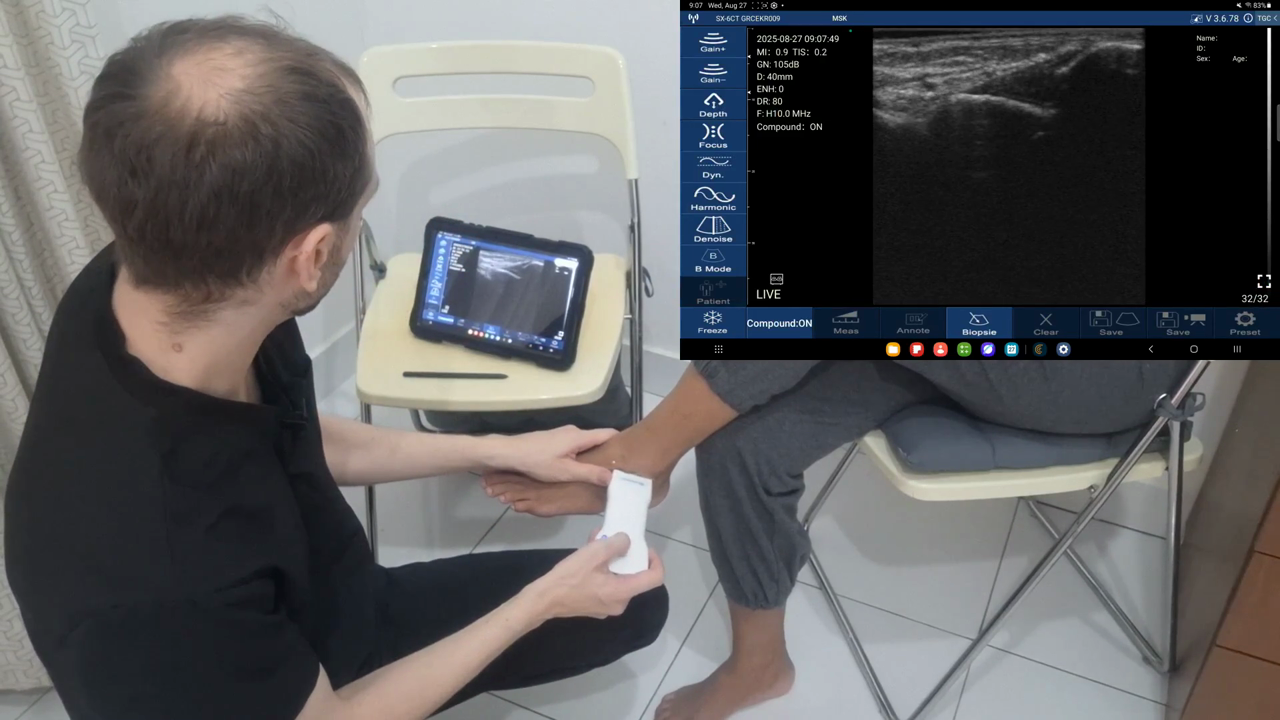 Anterior talofibular ligament · B-mode · D3Ultra · 10 MHz scan preview