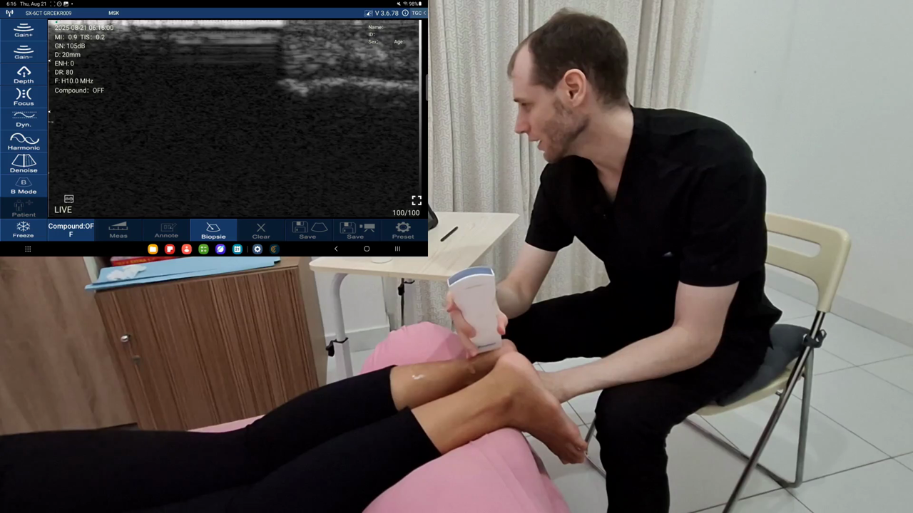 Achilles tendon · B-mode · D3Ultra · 10 MHz scan preview