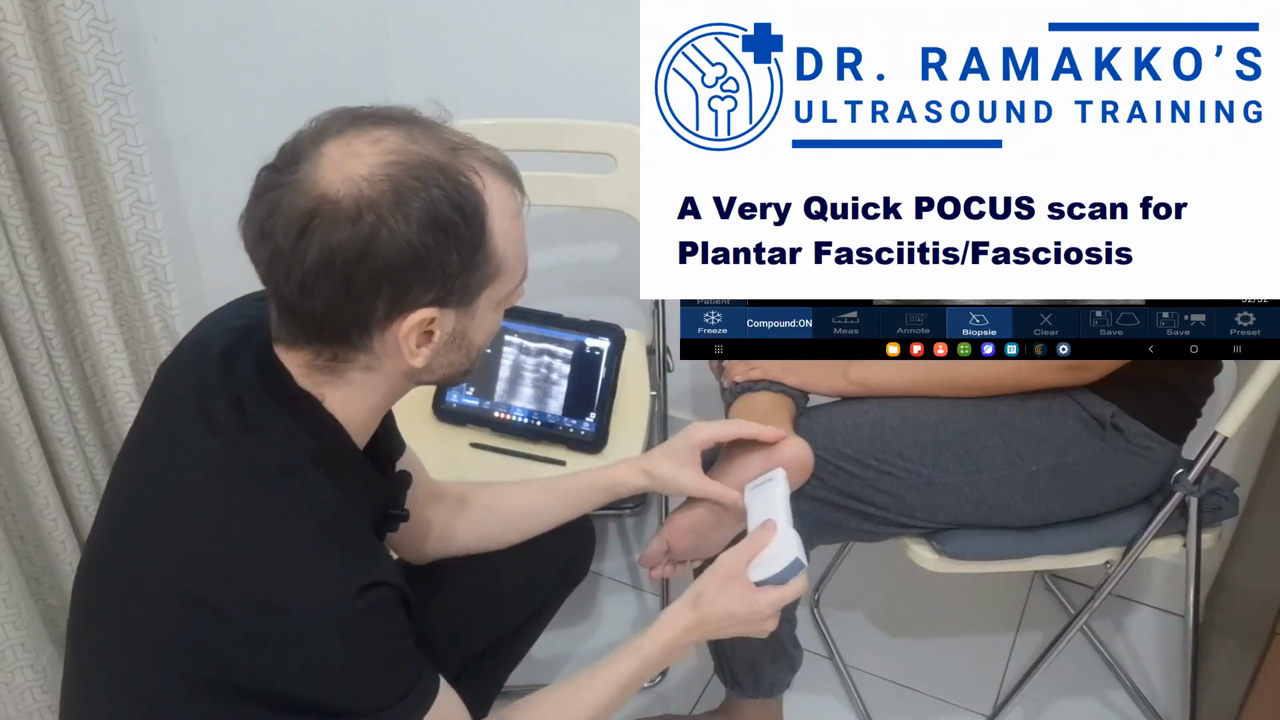 Plantar fascia · B-mode · D3Ultra · 10 MHz scan preview