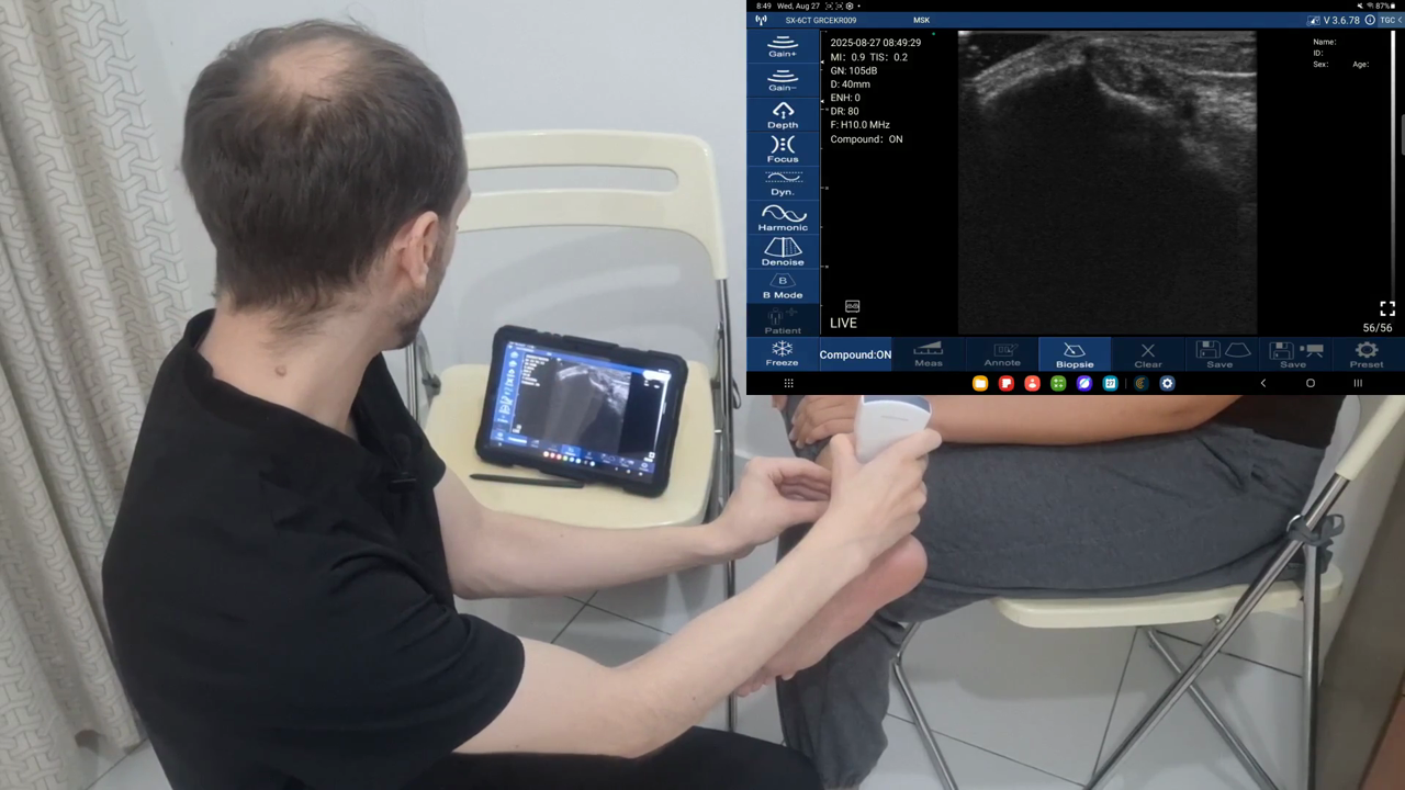 Tibialis posterior tendon · B-mode · D3Ultra · 10 MHz scan preview