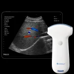 Suresult C5SH convex probe with tablet showing a colour Doppler scan