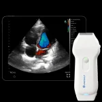 Suresult CD2 dual-head probe with tablet showing a colour Doppler cardiac scan