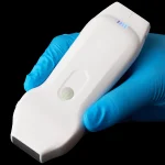 Suresult CD2 dual-head ultrasound probe held in a gloved hand