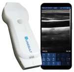 suresult cd2 handheld herz ultraschall lineare phasensonde
