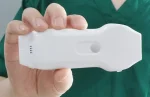 Suresult CD2 dual-head ultrasound probe held in hand
