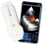 suresult cd2 Linear-Phased-Array-Handheld-Ultraschallscanner mit zwei Sonden