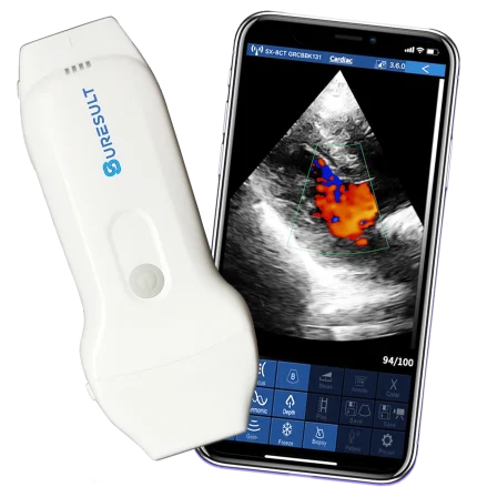 suresult cd2 Linear-Phased-Array-Handheld-Ultraschallscanner mit zwei Sonden