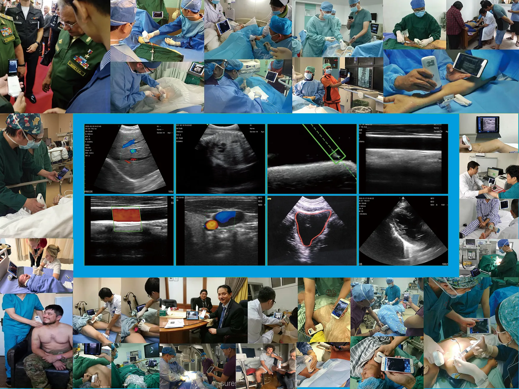 Wall of clinical cases from Suresult users — surgery, ICU, outpatient and bedside scans with a grid of live ultrasound images