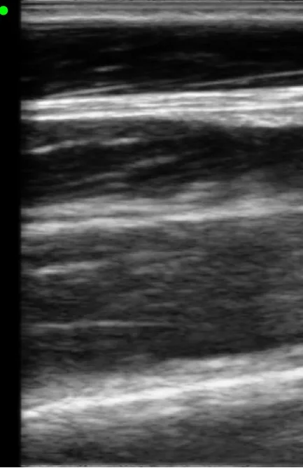 Fibrillar tendon structure