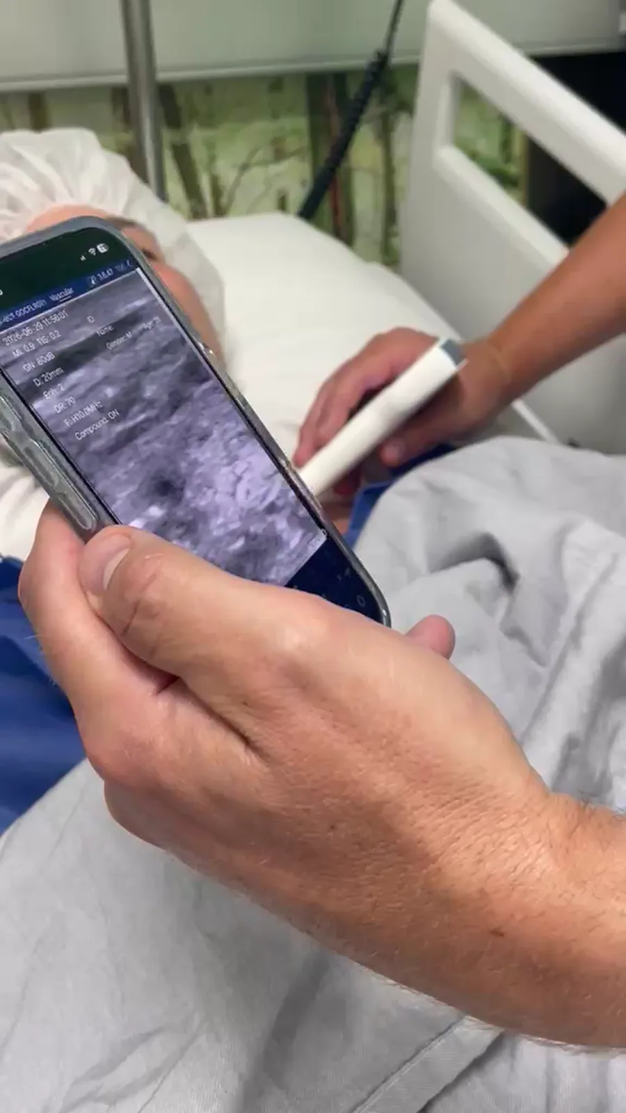 Scanworkflow hals · B-mode · lineaire probe-scanvoorvertoning