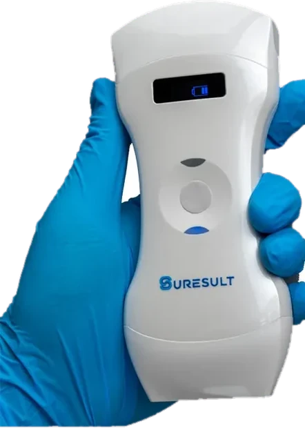 Suresult D3Pro dual-head handheld ultrasound scanner held in a gloved hand
