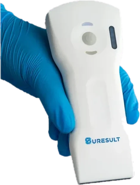 Suresult D3Ultra tri-mode handheld ultrasound probe held in a gloved hand