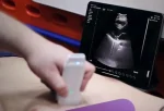 suresult Handheld-Ultraschallgerät für das Herz cd2