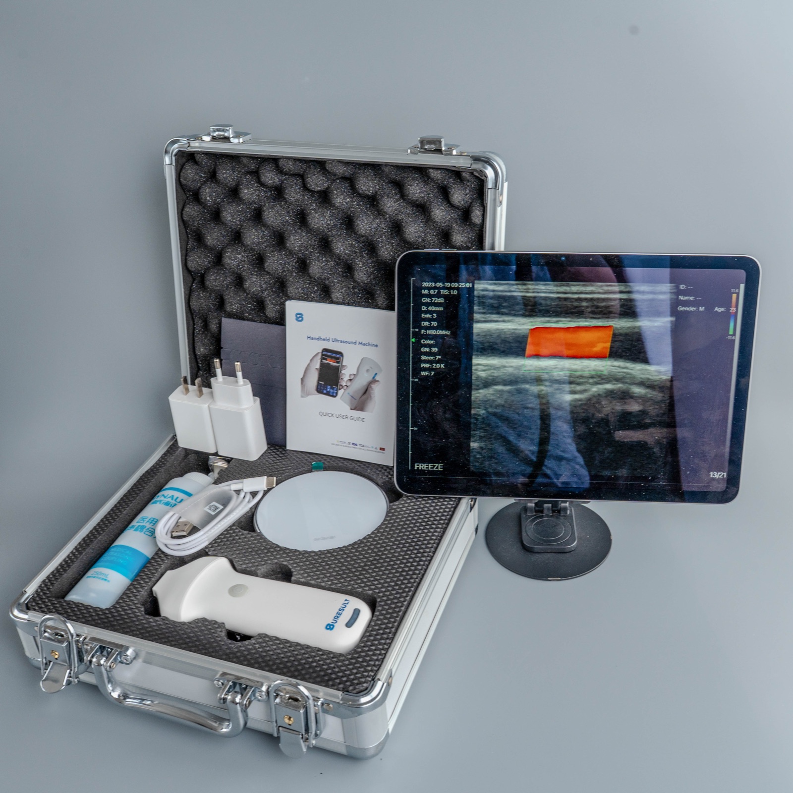 Suresult handheld ultrasound kit as delivered: aluminum flight case with probe, gel, chargers, wireless charging pad and tablet showing a color Doppler scan