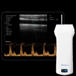 Suresult L10H linear probe with tablet showing a pulsed-wave Doppler scan