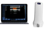 Suresult L10H 7.5/10 MHz linear ultrasound probe with 40 mm footprint
