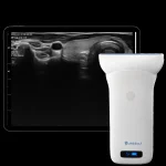 Suresult L10W wireless linear ultrasound probe with tablet showing a thyroid scan