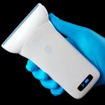 Suresult L10W wireless linear probe in a clinician's gloved hand
