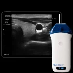 Suresult L14 linear probe with tablet showing a thyroid scan