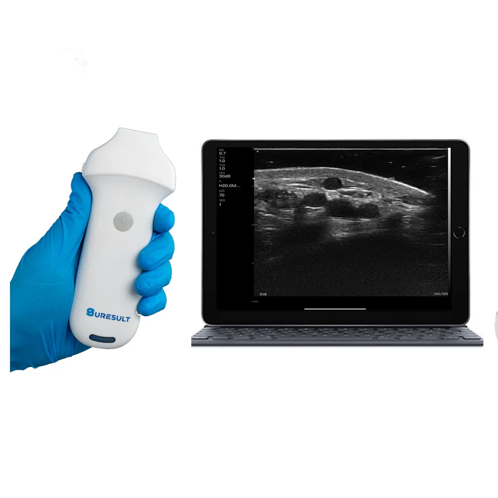 Suresult L20 16/20 MHz high-frequency linear ultrasound scanner