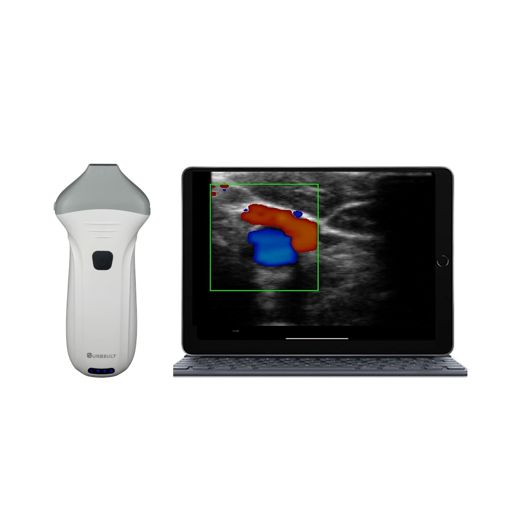 Suresult L24Pro 18 24 MHz rheumatology ultrasound probe