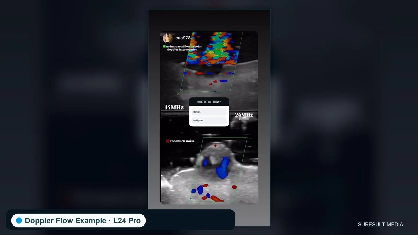 Facial superficial vessels · Color Doppler · L24Pro · Linear probe scan preview