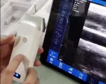 Suresult L7.5 linear probe in use with a tablet