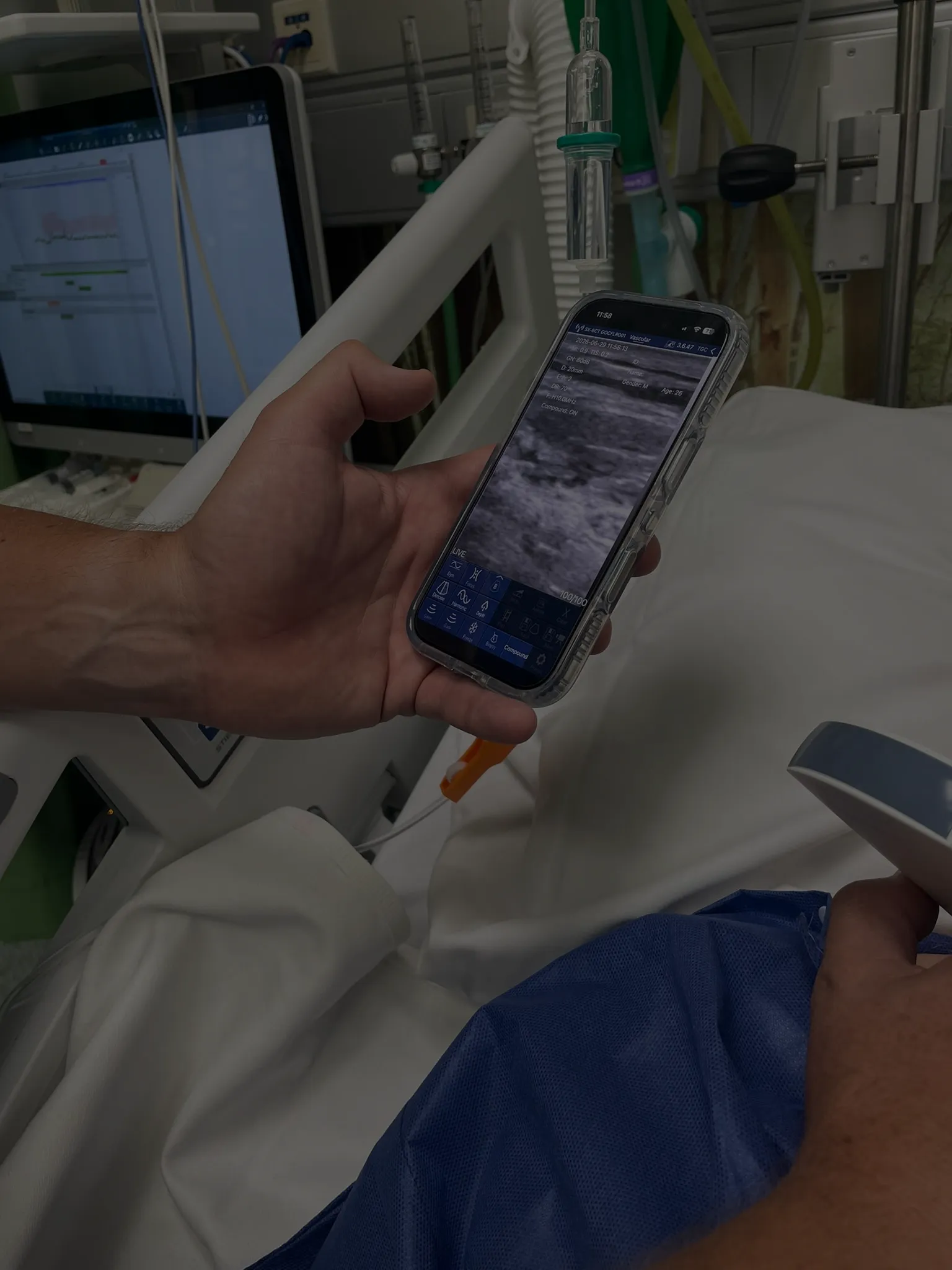Suresult specialist guiding an ultrasound-led procedure