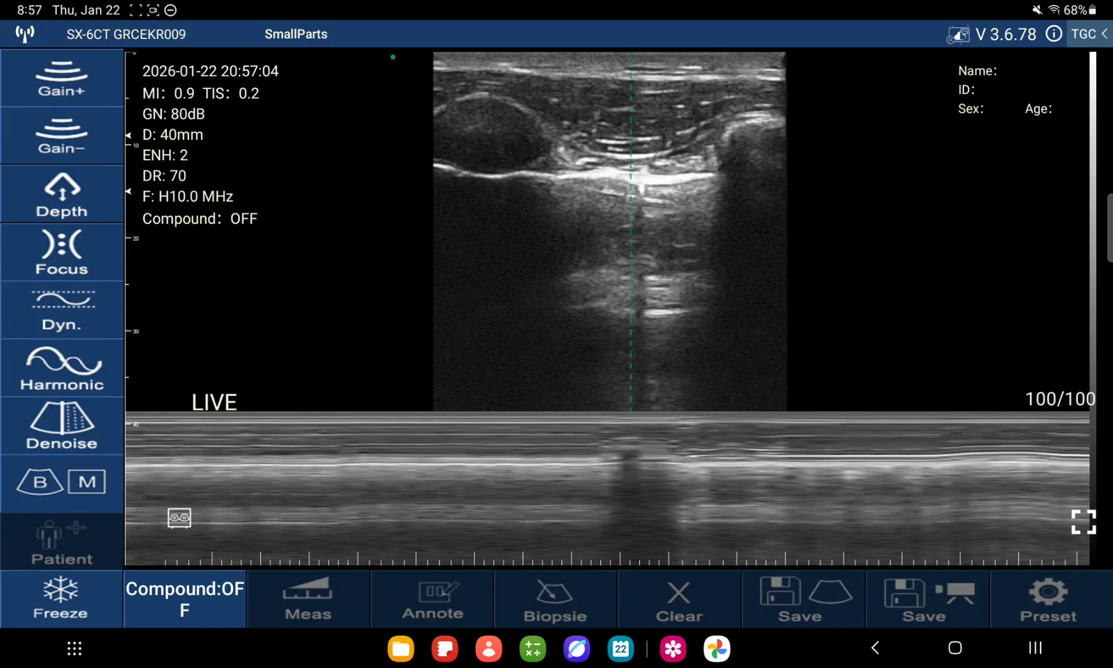 Pleuralijn bovenste longveld · B-mode + M-mode · D3Ultra · 10 MHz scanvoorbeeld