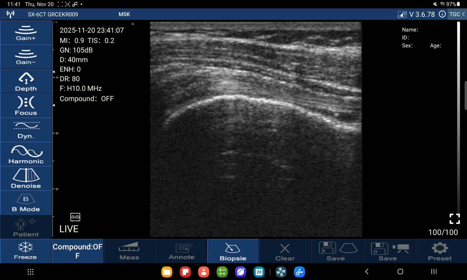 Bicepspees · B-mode · D3Ultra · 10 MHz scanvoorvertoning