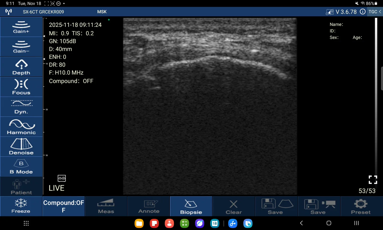 Gluteus medius-pees · B-mode · D3Ultra · 10 MHz scanvoorbeeld