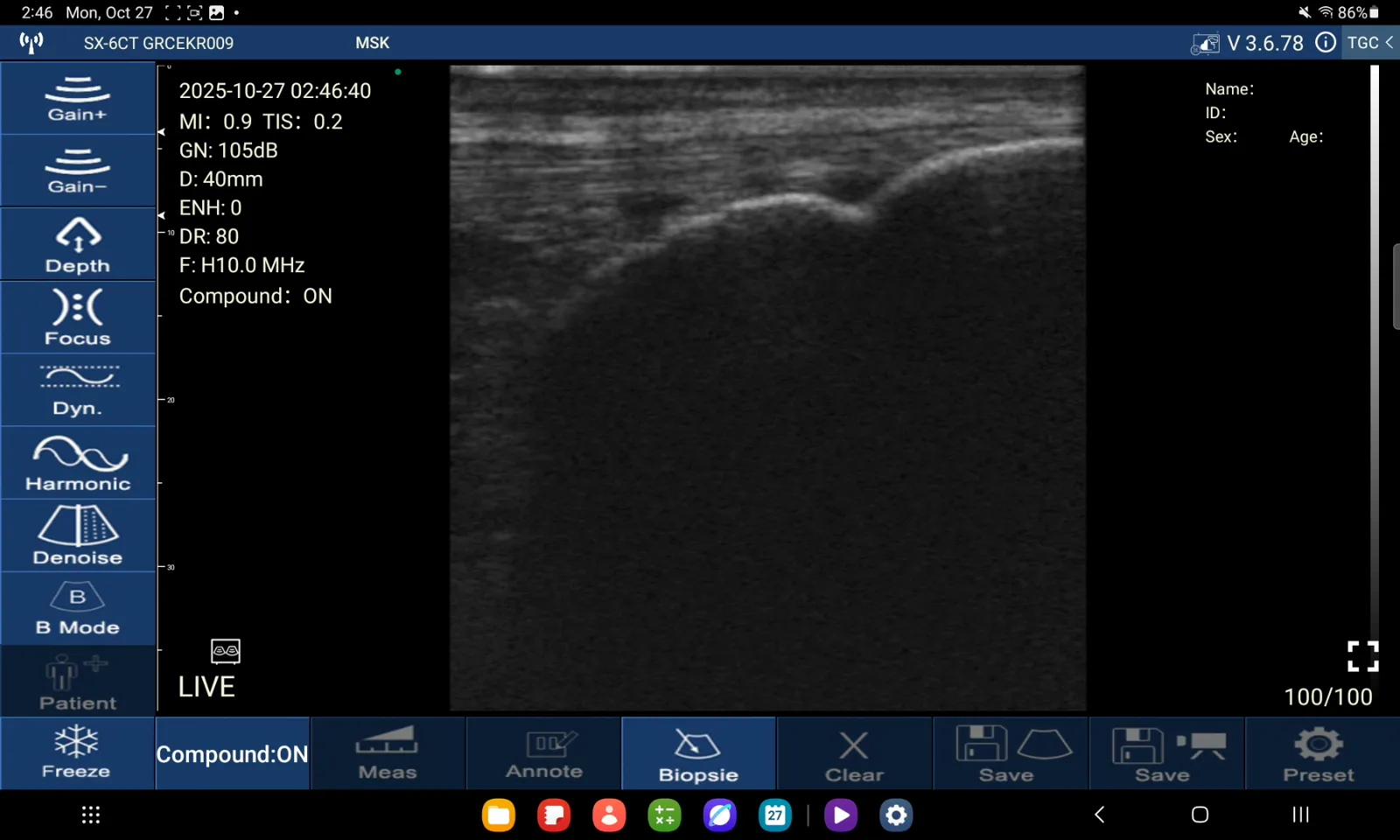 Patellapees · B-mode · D3Ultra · 10 MHz scanvoorbeeld