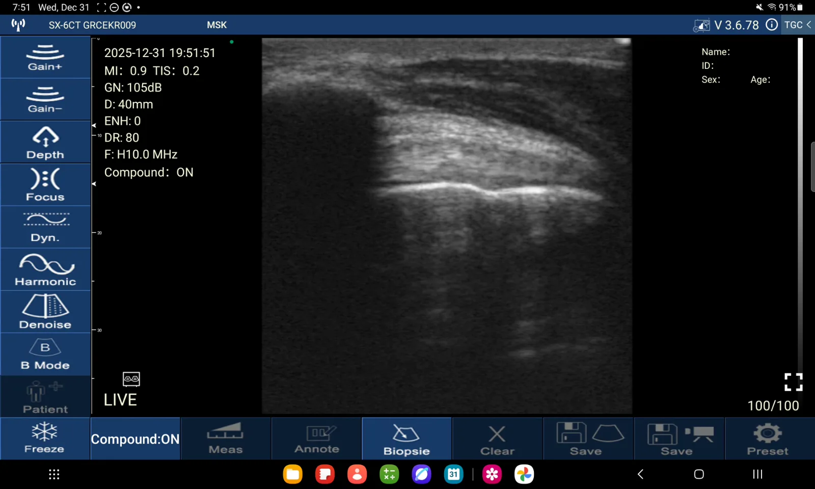 Supraspinatuspees · B-mode · D3Ultra · 10 MHz scanvoorbeeld