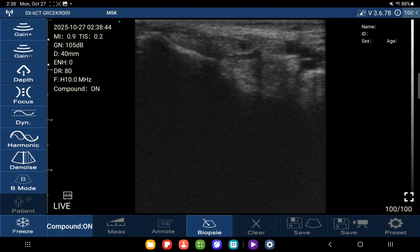 Tibialis posterior-pees · B-mode · D3Ultra · 10 MHz scanvoorbeeld