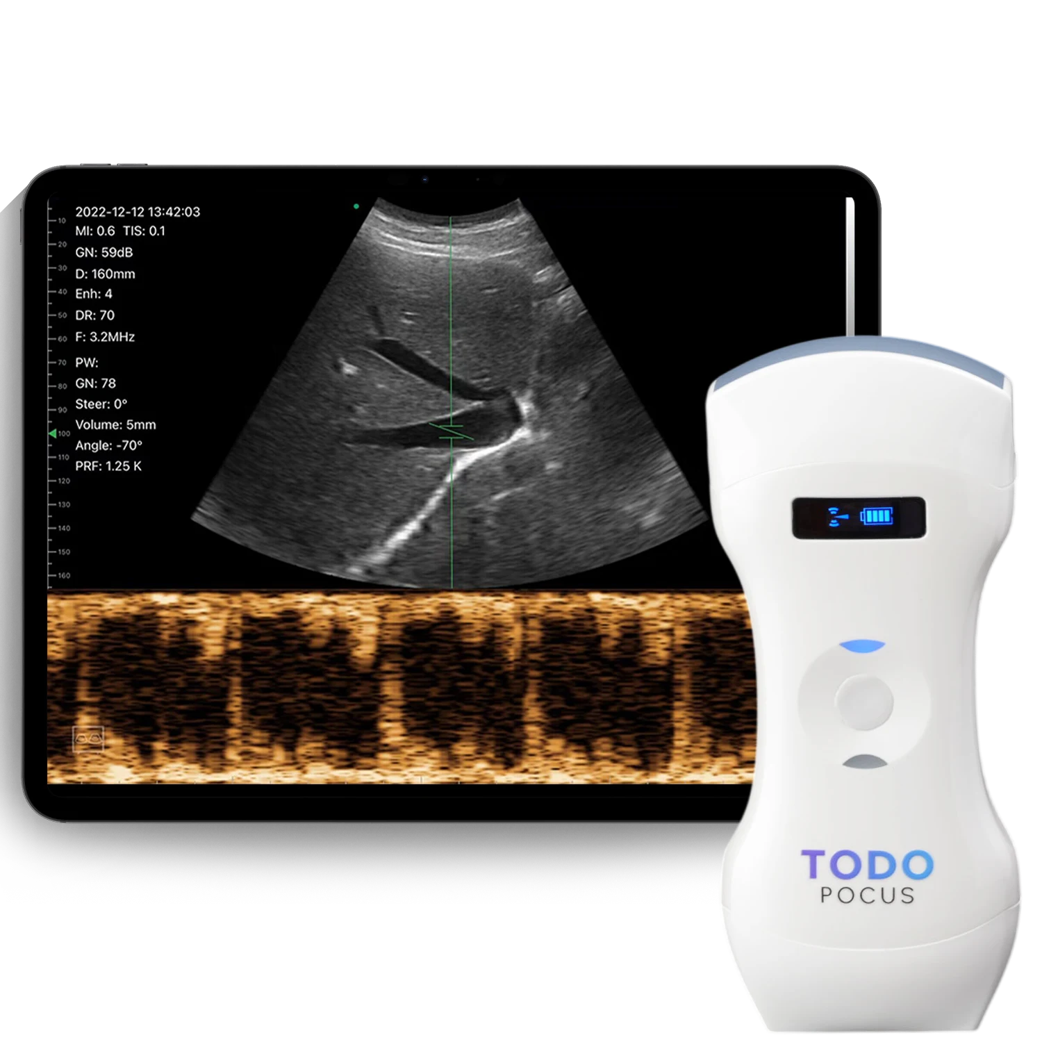 Productafbeelding van TodoPocus D3Pro handheld echografie voor vergelijking door kopers