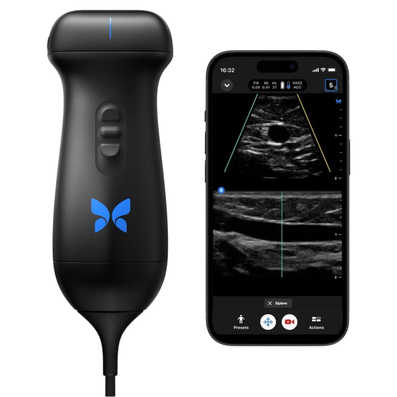 Butterfly iQ3 single-probe handheld ultrasound system