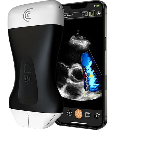Clarius PAL HD3 phased and linear handheld ultrasound scanner